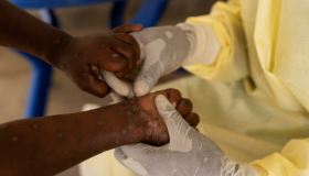 En caso de detectar un caso sospechoso, es imperativo que este sea investigado de manera inmediata.