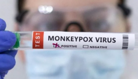 Pakistán registró su primer caso de viruela del mono y dos sospechosos