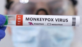 Honduras instala salas de vigilancia epidemiológica para detectar posibles casos de mpox