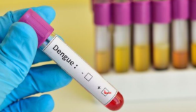 Nadie debe morir por dengue si acude el primer día de síntomas al médico: Tito Alvarado