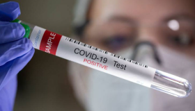 La COVID-19 es un virus más 5 años después, pero la OMS se mantiene en alerta 