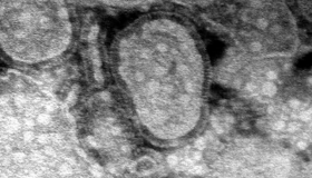 China enfrenta nuevos problemas con una enfermedad respiratoria similar al Covid-19 