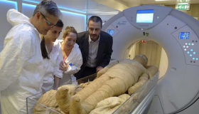 Descubren en una momia el origen de terrible enfermedad que mató a más de 50 millones de personas 