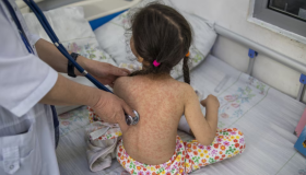 Lo que debe saber sobre el sarampión: contagio, vacunación y riesgos de una enfermedad potencialmente mortal 