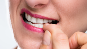 Onicofagia: cuando morderse las uñas se convierte en un riesgo para la salud 