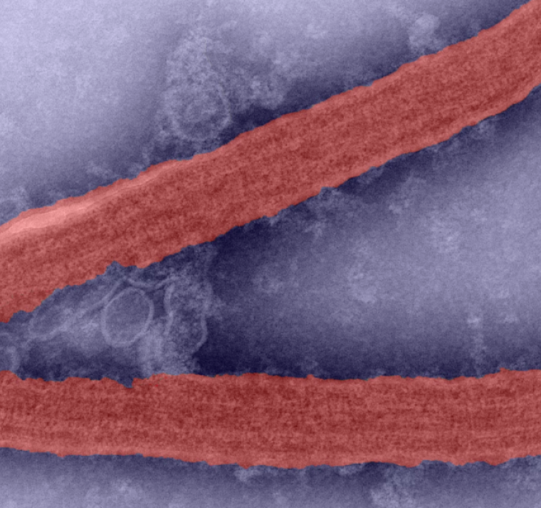 La OMS advierte de una enfermedad incurable causada por un virus altamente infeccioso