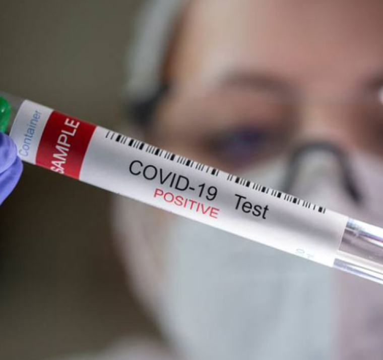 La COVID-19 es un virus más 5 años después, pero la OMS se mantiene en alerta 