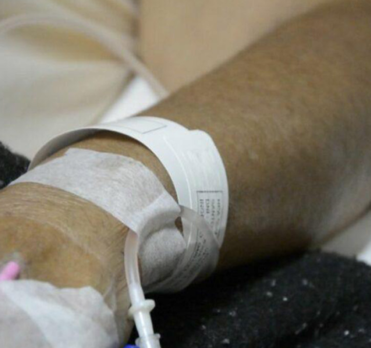 Bolivia reporta el primer fallecimiento por covid-19 de 2025 