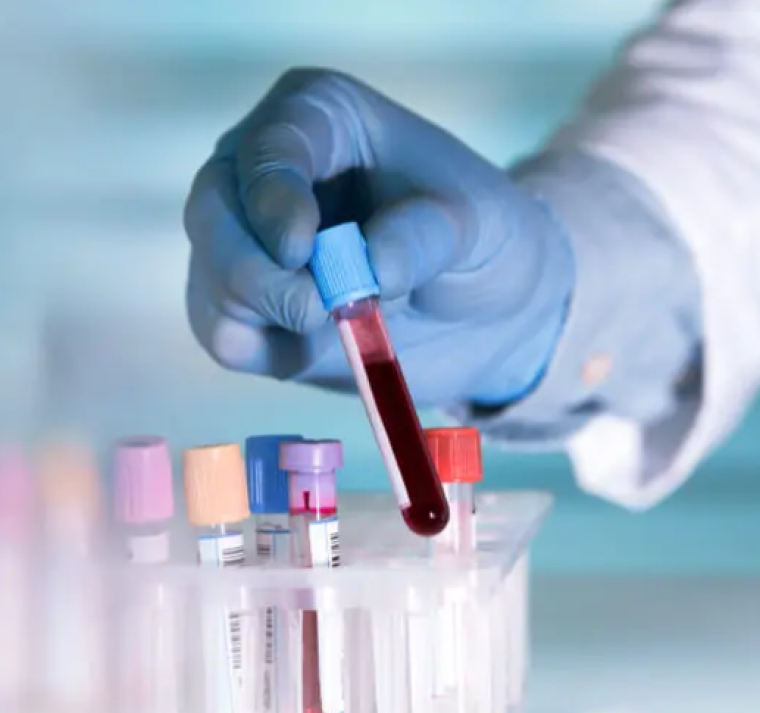 Japón desarrolla sangre artificial apta para cualquier tipo sanguíneo