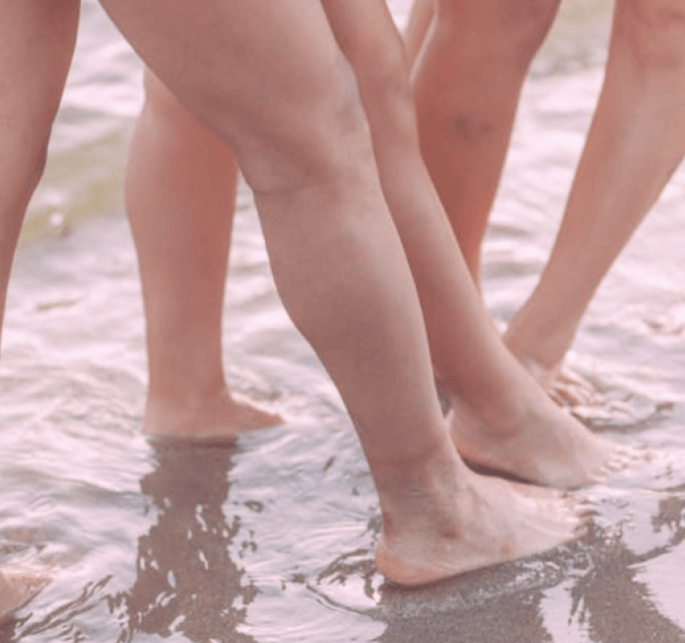 Cómo diferenciar la celulitis, la linfedema y el lipedema